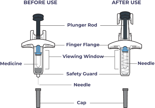 OMLYCLO prefilled syringe before and after use, showing the plunger rod, finger flange, viewing window, medicine, safety guard, needle, and cap.